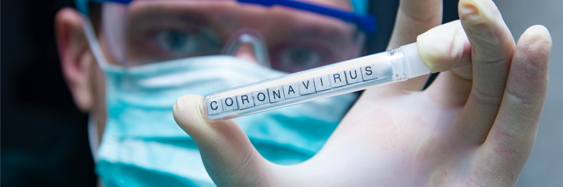 Mann mit Schutzbrille, Mundschutzmaske und Haarhaube hält ein Proberöhrchen